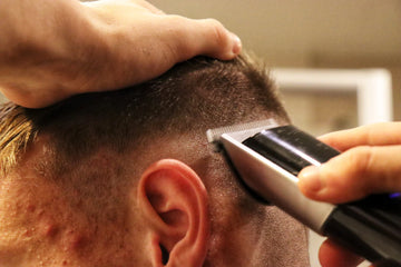 Effective Minoxidil Treatments for Men's Hair Regrowth