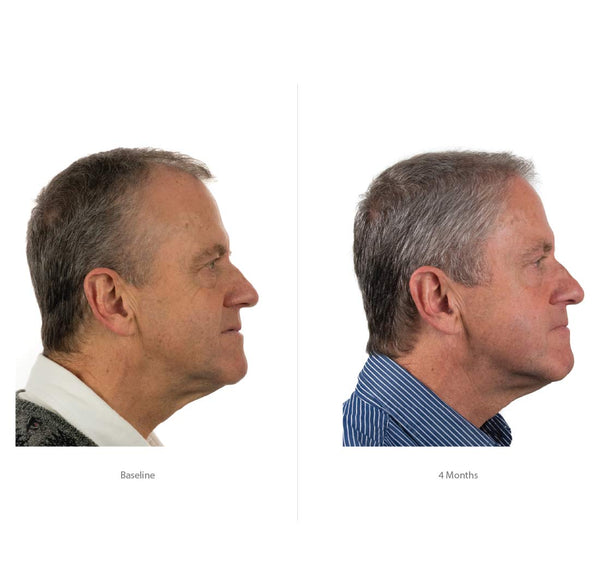 FOLIGAIN Hair Growth Shampoo + Conditioner Kit For Men - FOLIGAIN EUROPE